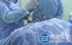 视频素材：实拍4K分辨率医生腹腔镜手术台操作场景素材